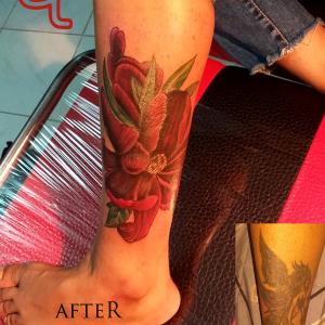 Flower (cover up) tattoo by Dr.Ink Atkatattoo